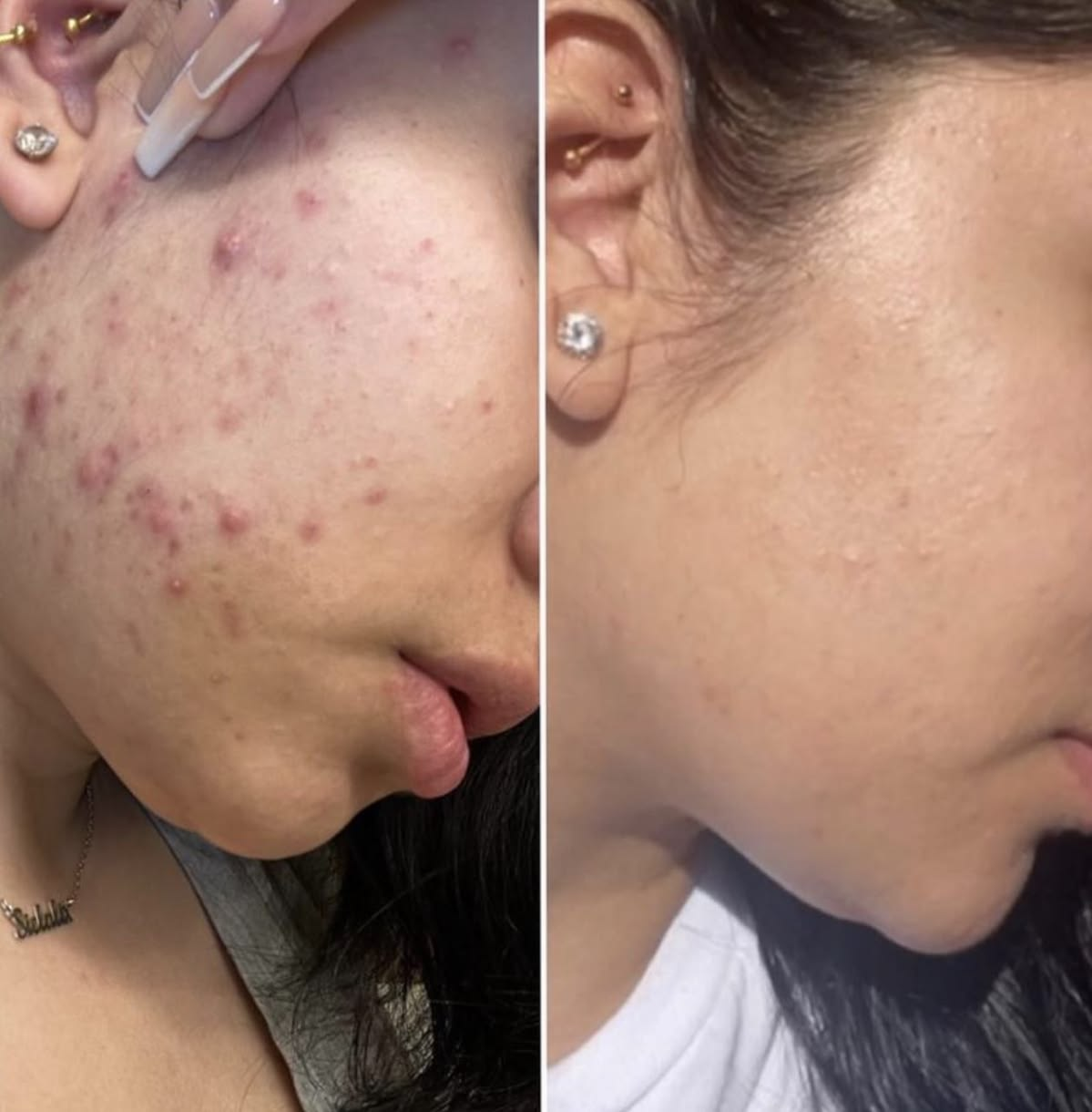 Antes e depois Kit Vitamina C - foto 2