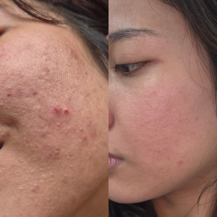 Antes e depois Kit Vitamina C - foto 4